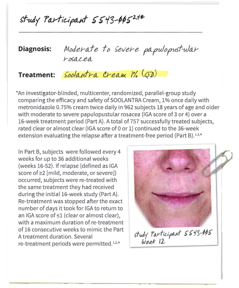 ....